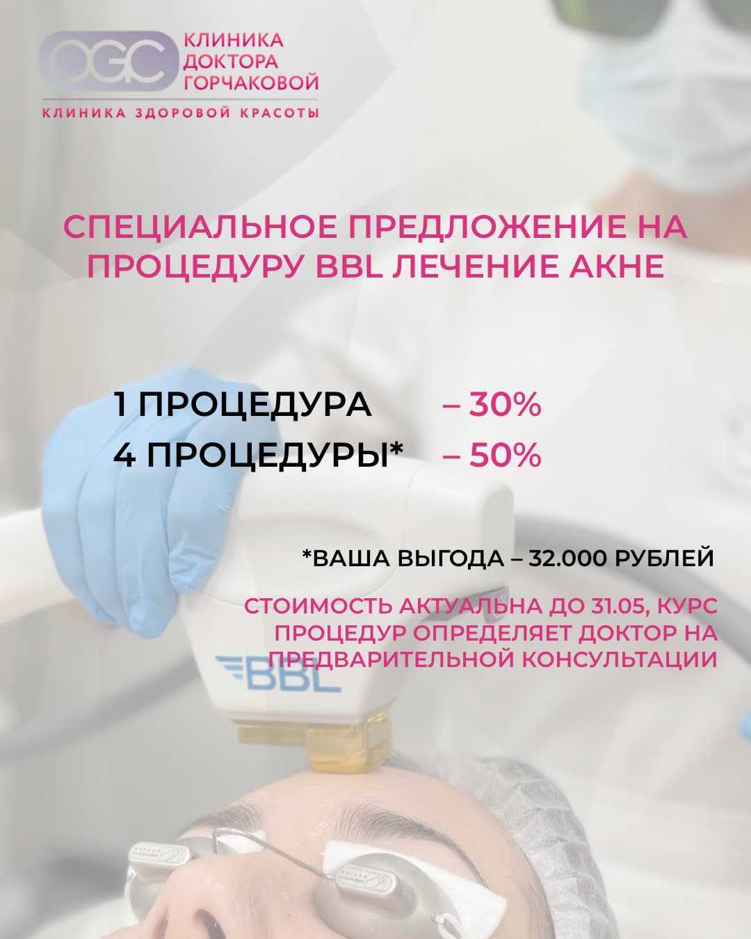 Надоело акне? BBL со скидкой до 50% – ваше решение! Акция до 31 мая.