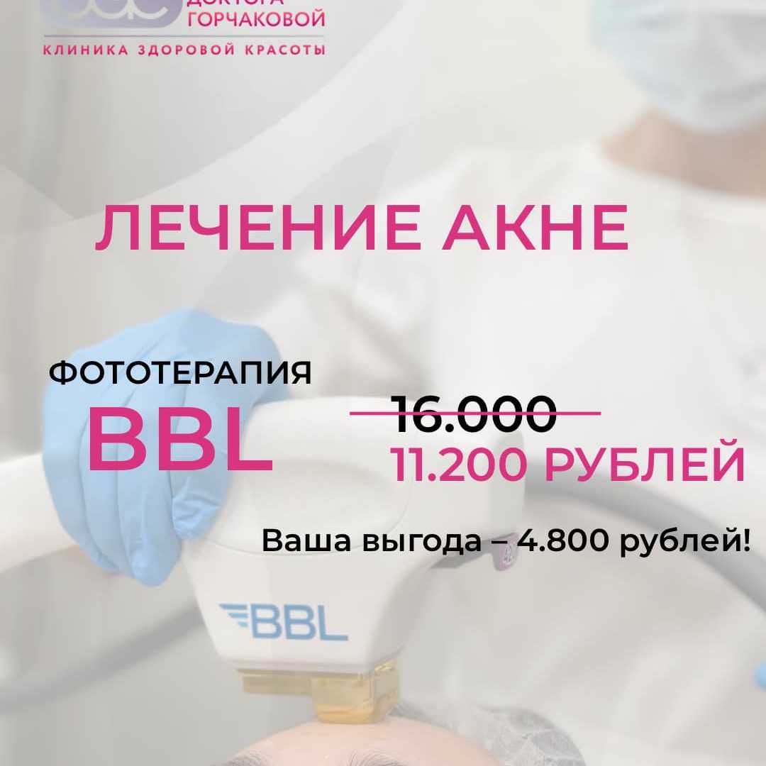 Спецпредложение: BBL против акне за 11 200 ₽