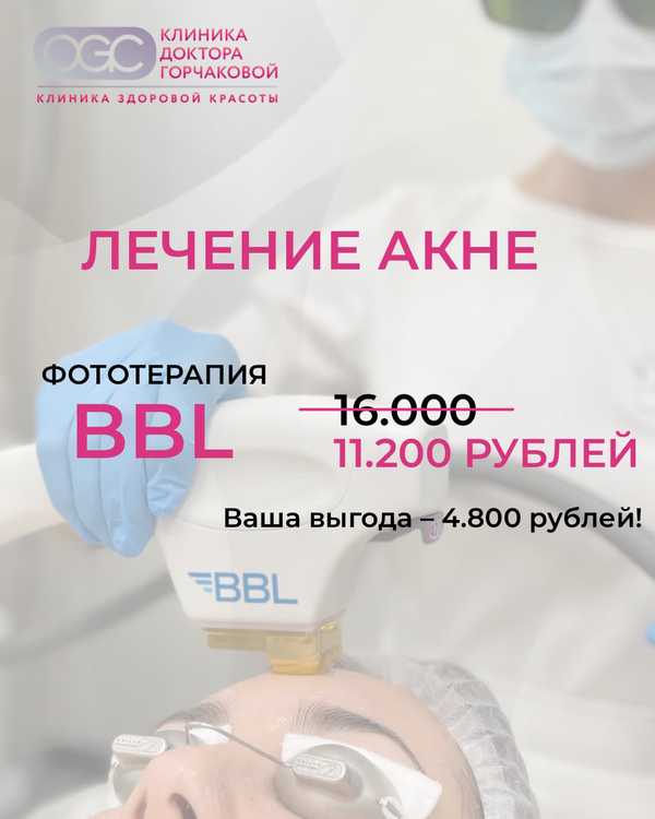Спецпредложение: BBL против акне за 11 200 ₽